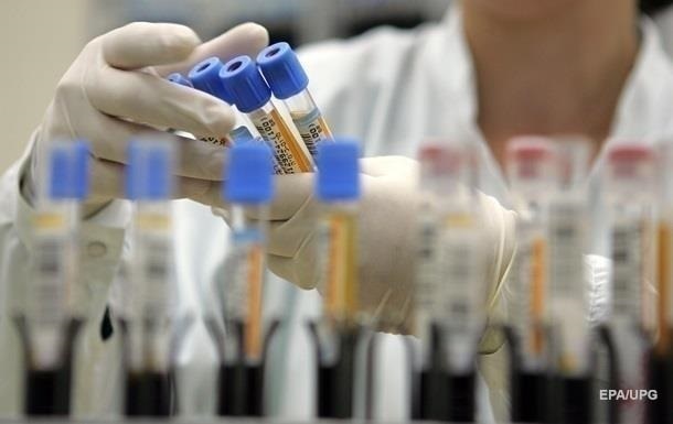 Украина получит спецоборудование для диагностики нового коронавируса