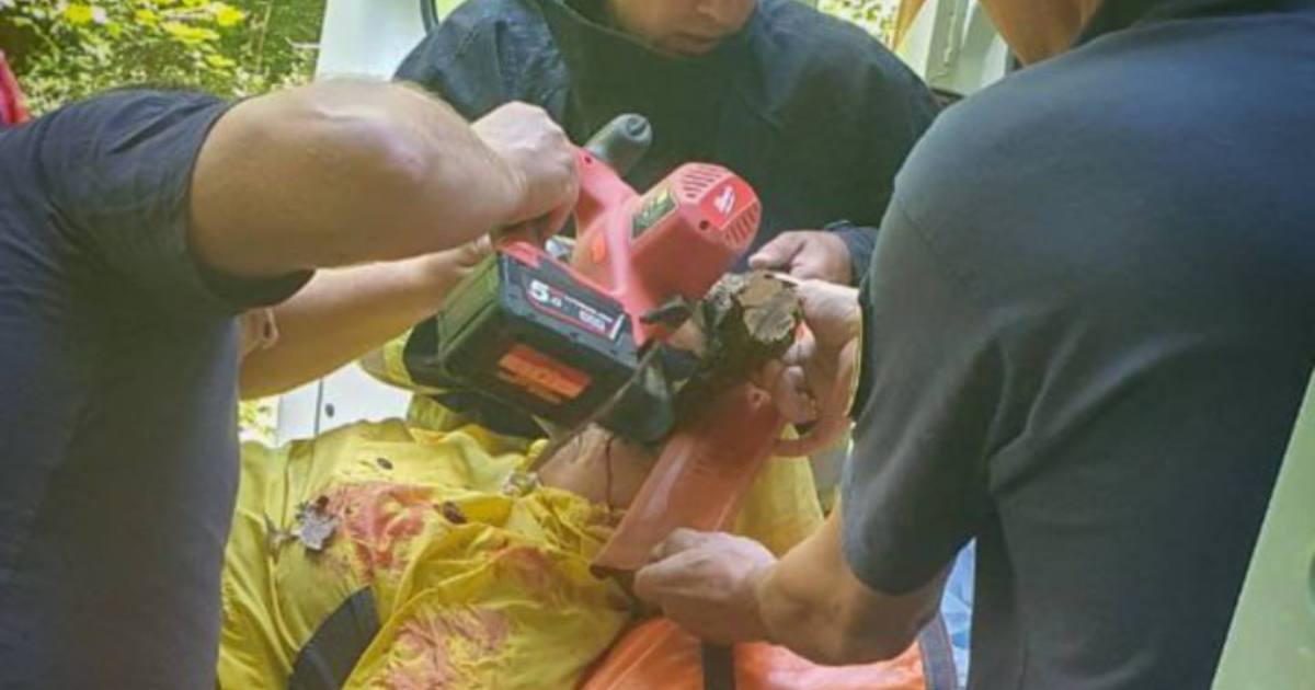 Спасатели обрезали остатки ветки возле глаза 66-летней грибницы / Фото ГСЧС