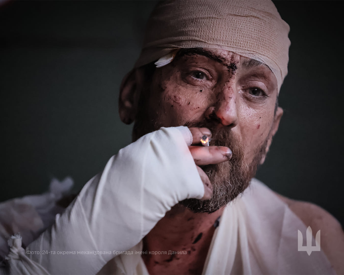 Поранений воїн на стабілізаційному пункті / Фото: 24 ОМБр імені короля Данила