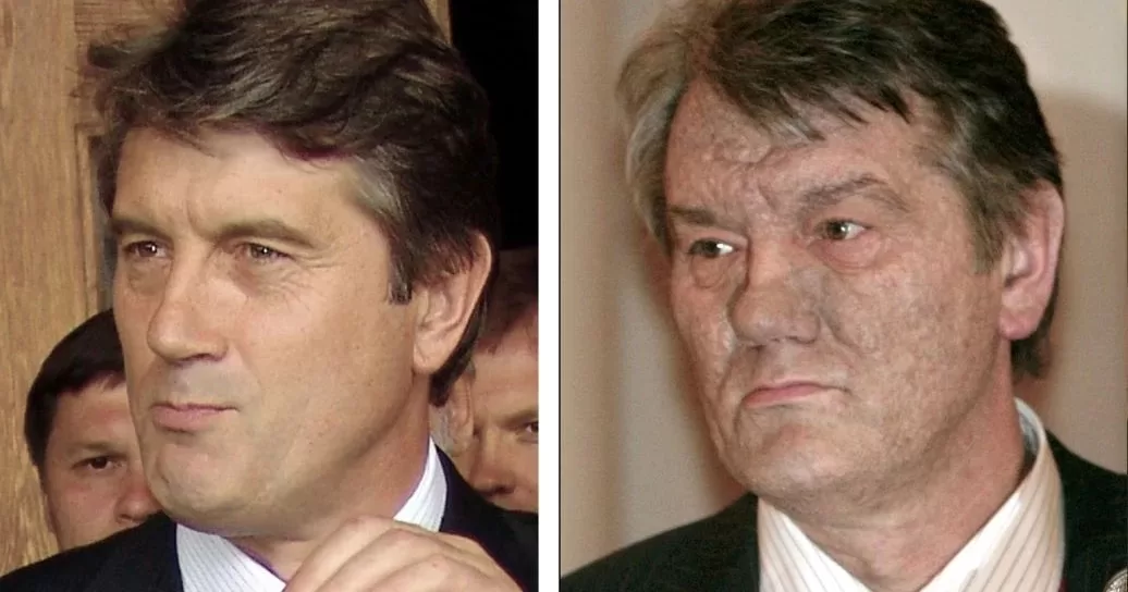 Виктор Ющенко до и после отравления диоксином в 2004 году / Фото: Associated Press