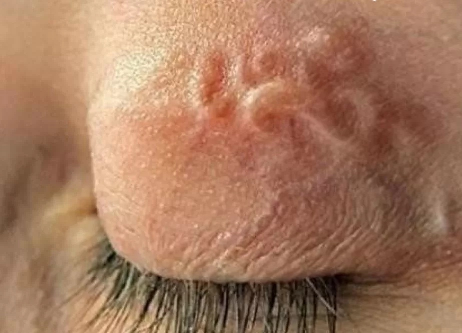 Ілюстративне фото / Харківський обласний центр контролю та профілактики хвороб