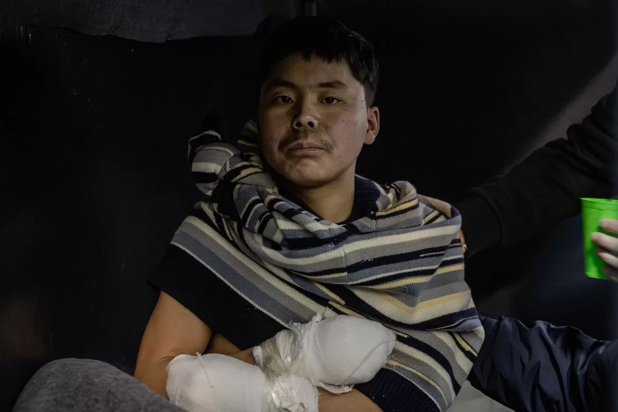 A North Korean soldier captured by the Ukrainian Armed Forces in the Kursk region of the Russian Federation / Photo: x/ZelenskyyUa