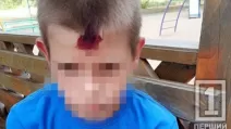 Раненый мальчик / Фото: Первый городской телеканал Кривого Рога