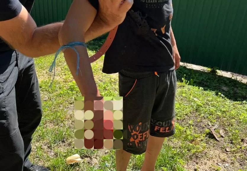 Полицейский останавливает кровь у ребенка / Фото: Полиция Хмельницкой области