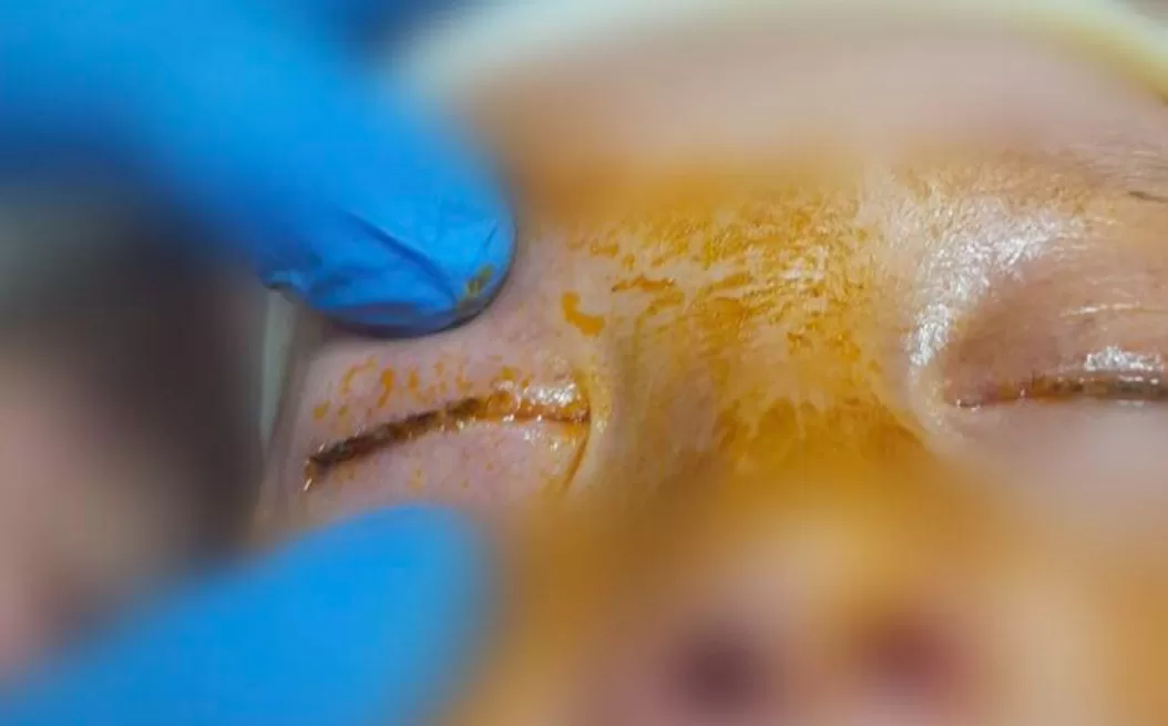 Медики спасли зрение мальчику, который заклеил себе глаза суперклеем / Фото: Закарпатская областная детская больница