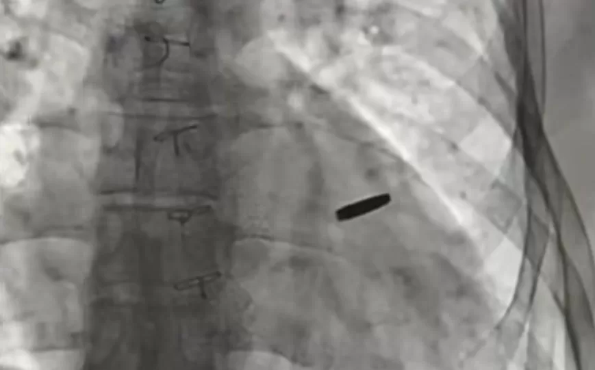 Куля в серці військового / Кадр з відео