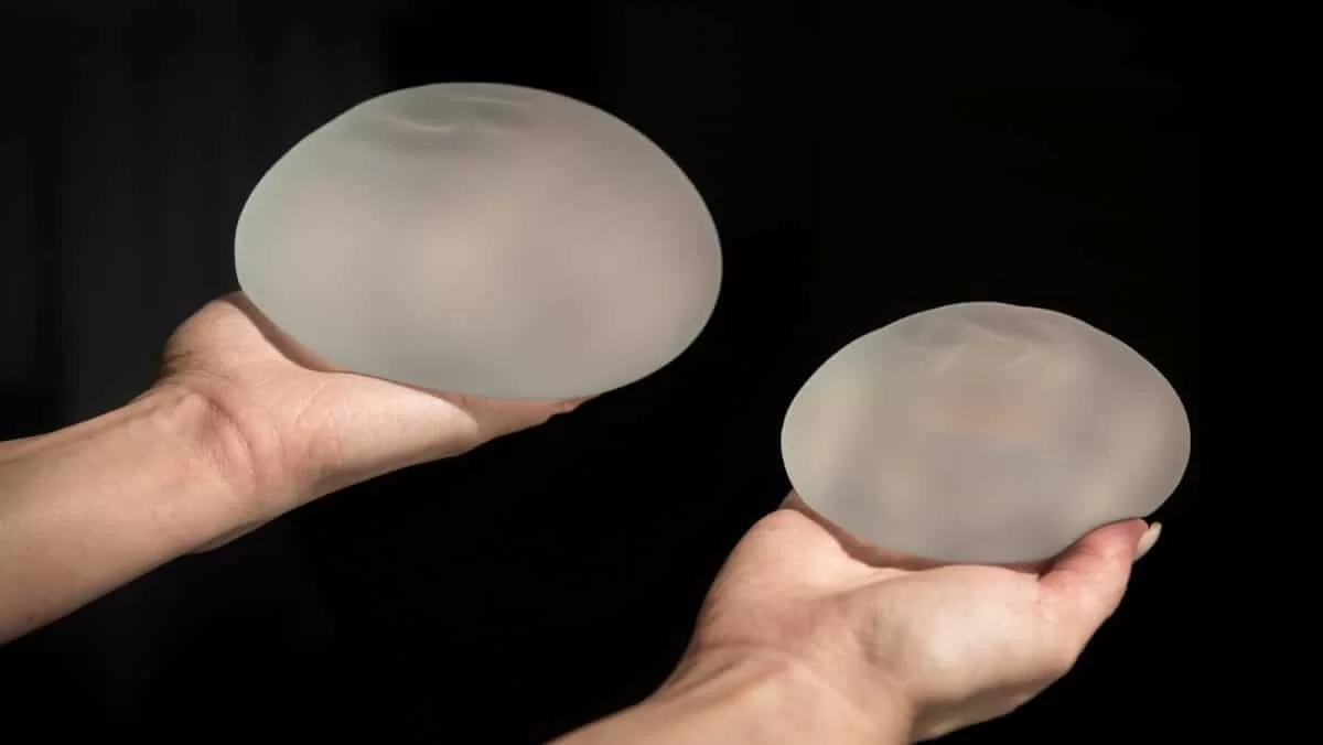 Ілюстративне фото з відкритих джерел