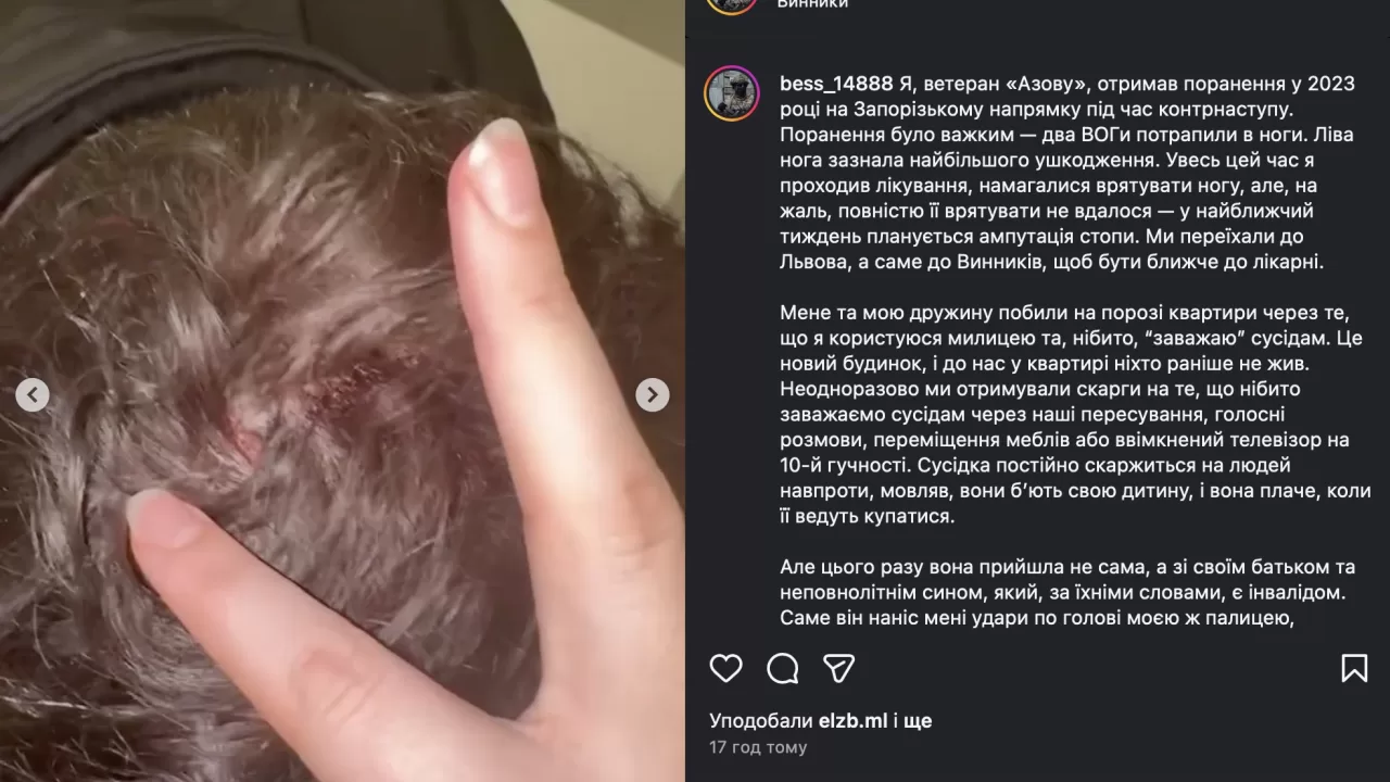 На Львівщині сусіди побили ветерана Азову, який заважав їм своїми милицями