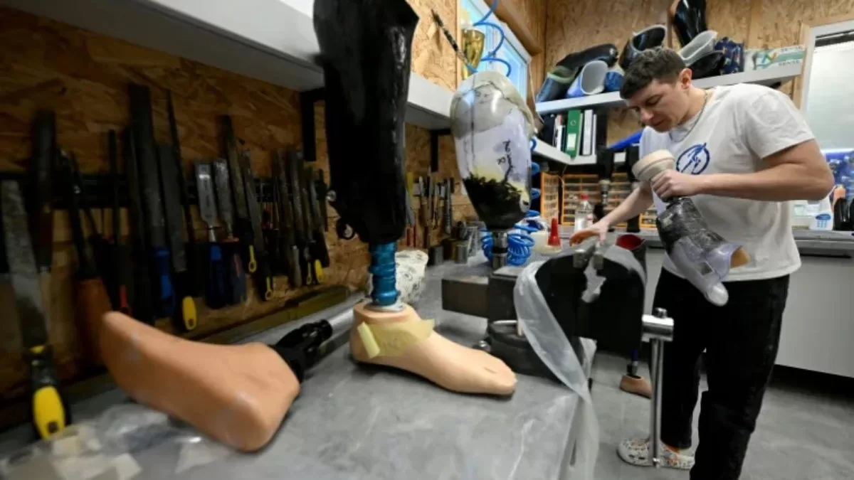 В России растет количество раненых военных, нуждающихся в протезировании / Фото AFP