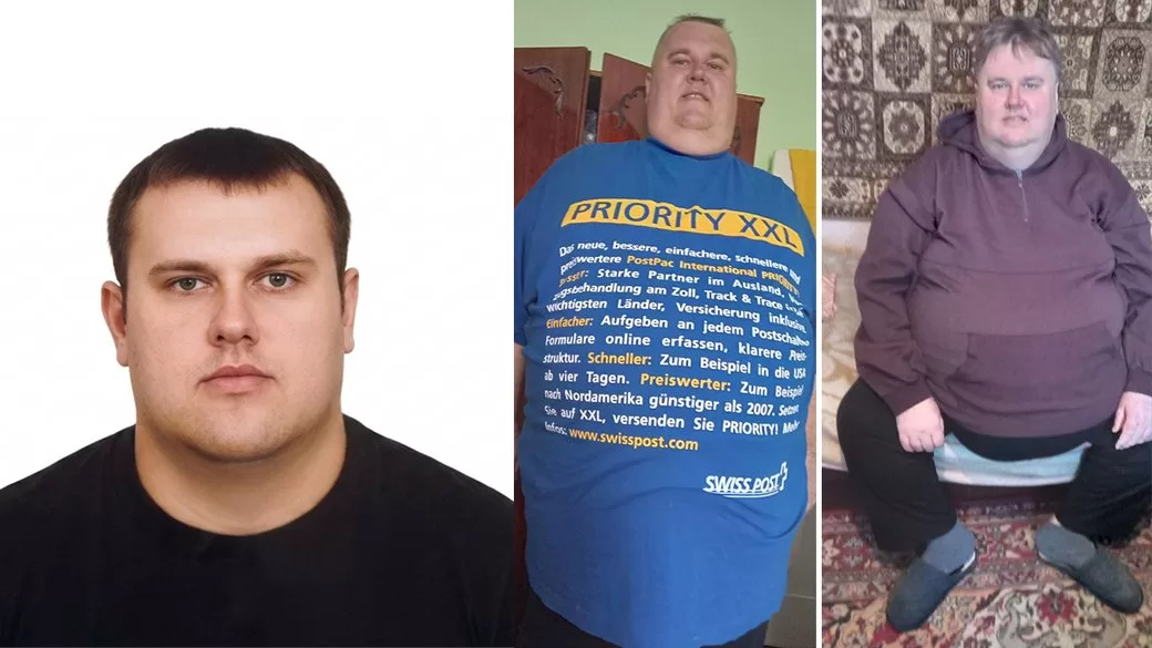 Андрей Стесюк до и после болезни / Фото: Суспільне Житомир