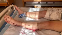 В Краматорске ранены четверо спасателей после удара беспилотника / Фото: ГСЧС