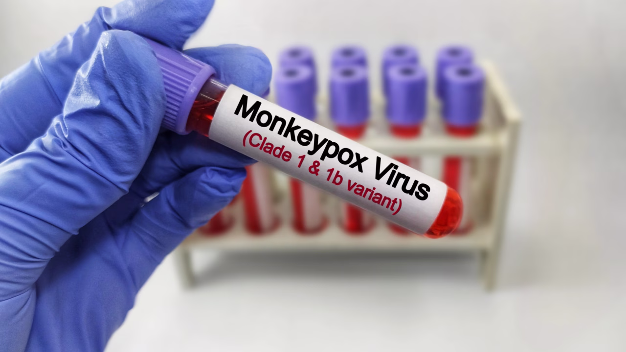 Пробірка з маркуванням Monkeypox Virus під час лабораторного дослідження / Ілюстративне фото: Depositphotos